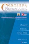 Image de Infecciones del sistema nervioso central