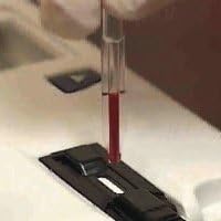 Cardiochek Safetec Pipette 15uL (Pack of 25) (BIOP2863)