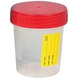 Saraoriginalshop 4x contenitore per Urine Urinocoltura contenitore per Analisi prodotto Strerile capacità 120 ml coperchio a 