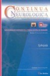 Image de Continua Neurológica. Epilepsia