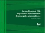 Image de Casos clínicos de ECG en pacientes hipertensos en diversas patologías cardiacas