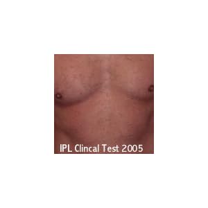IPL800 professionellen Salon Qualität IPL-System für die Hautpflege, Tattooentfernung und dauerhafte Haarentfernung… - Image 5