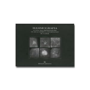 Mammografia. Guida alla refertazione ed alla codifica dei risultati RE.CO.R.M.