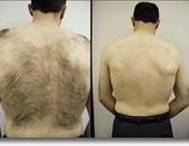 Sunzze Vliesstreifen 300Stck FOR MAN für die Enthaarung mit Warmwachs Profi Packung XL 22 x 8 cm - 2