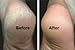 BEST RATED Baby Foot Peel Pedicure Mask by Grace & Stella® - Odor Eliminator & Callus Remover - 100% Satisfaction Guarantee - Do It Yourself At Home Moisturizing Cuticle Soaks Socks (UK Seller) (1 Pair (£9.95/pc), Lavender)