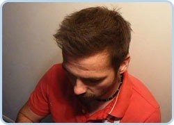 Mane Haarauffüller & Ansatzkaschier Spray zur Haarverdichtung 200ml, Schwarz – Black - 8