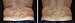 2 Body Wrap Applicator
