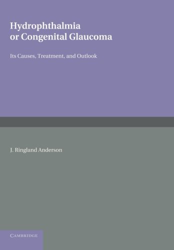 Hydrophthalmia or Congenital Glaucoma: Its Causes, Treatment, And Outlook by J. Ringland Anderson (2013-10-31)