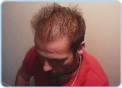 Mane Haarauffüller & Ansatzkaschier Spray zur Haarverdichtung 200ml, Schwarz – Black - 4