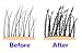 Hair Genetics® Advanced Keratin Hair Building Fibres Large 22g Dispenser, Natural, Thick & Textured, Amazing New Concept to Save Money, Professional Quality Fiber, Hair Loss Concealer Fibers For use by Men and Women. (Medium Brown)