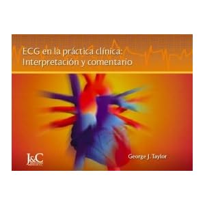 ECG en la práctica clínica: Interpretación y comentario