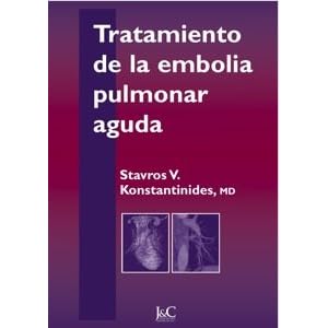 Tratamiento de la embolia pulmonar aguda