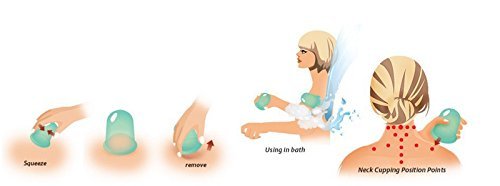 Edealing 2 PCS Schröpfen Set chinesische Therapie Cellulite medizinische Vakuum Silikon Massage Cups - 6