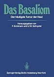 Das Basaliom: Der häufigste Tumor der Haut