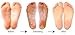 Purederm Exfoliating Foot Mask - Peels Away Calluses and Dead Skin in 2 Weeks! (2 Pack (2 Treatments), Regular) by Adwin Korea