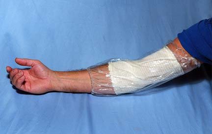 PICC LINE Cover - 7 pack - Large - Elbow/Knee, Waterproof, Guard, Protector