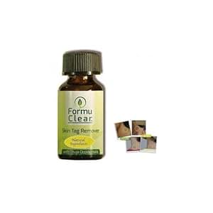 FORMU CLEAR SKIN TAG REMOVER. Simple and Safe Brush On Plant Based Skin ...