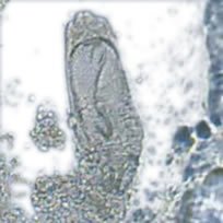 Wurmmittel Fische, Parasitenmittel Koi – wurmfrei, karpfenlausfrei, Parasitenbekämpfung mit Cyromazin – beseitigt schonend, dauerhaft und nachhaltig Würmer und andere Parasiten im Koiteich und am Koi. Tomodachi Wurmfrei Pro 1L Cyromazin Konzentrat ausreichend für 50.000L Teichwasser - 9