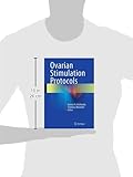 Image de Ovarian Stimulation Protocols