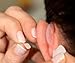 Otostick - TWIN PACK - Instant Correction for Prominent Ears