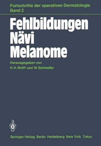 Fehlbildungen Nävi Melanome: 2 (Fortschritte der operativen und onkologischen Dermatologie)