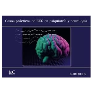 Casos prácticos de EEG en psiquiatría y neurología