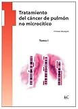 Image de Tratamiento del cáncer de pulmón no microcítico