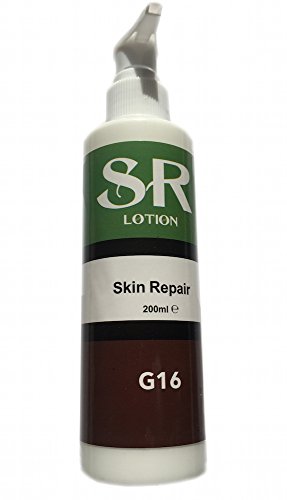SR Lotion, Excellent Ichthyosis Treatment Cream, Outstanding Results in 2 Weeks