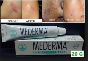 Mederma