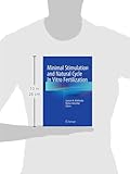 Image de Minimal Stimulation and Natural Cycle in Vitro Fertilization