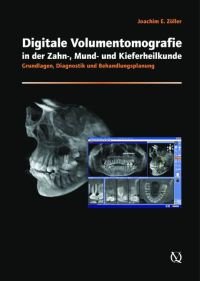 Preisvergleich Produktbild Digitale Volumentomografie in der Zahn-, Mund- und Kieferheilkunde: Grundlagen, Diagnostik und Behandlungsplanung, mit DVD-ROM