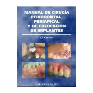 Manual cirugia periodontal