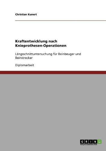 Preisvergleich Produktbild Kraftentwicklung nach Knieprothesen-Operationen: Längsschnittuntersuchung für Beinbeuger und Beinstrecker