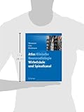 Image de Atlas Klinische Neuroradiologie: Wirbelsäule und Spinalkanal