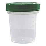 Taza de orina graduada. 500 vasos de muestras de orina de 100 ml con tapón de rosca verde.