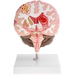 Modelo con Áreas funcionales y tronco cerebral extraíble