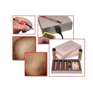 Epitron 85 Komplette professionellen Einsatz Permanent Hair Removal System. Wird von Mehr Professionals. - Image 4