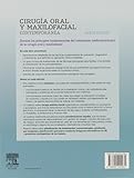 Image de Cirugía Oral Y Maxilofacial Contemporánea - 6ª Edición