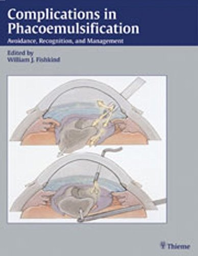 Preisvergleich Produktbild Complications in Phacoemulsification: Avoidance, Recognition, and Management
