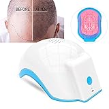 ※Sugerencias: Tiempo de irradiación 20 minutos, es el momento apropiado para activar el folículo piloso Puede mejorar la apariencia de la calidad del cabello, la fuerza del cabello y el grosor del cabello