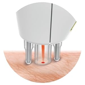 Rio Salon Laser Tweezer Hair Removal System - Image 2