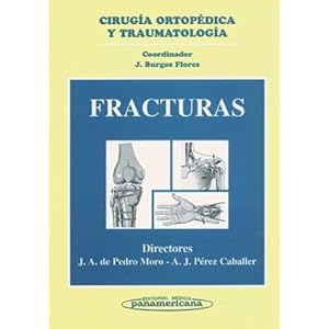 Fracturas. Cirugía Ortopédica y Traumatología