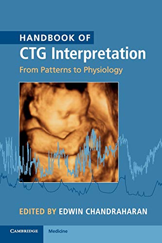 Handbook of CTG Interpretation: From Patterns to Physiology Handbook of CTG Interpretation: From Patterns to Physiology