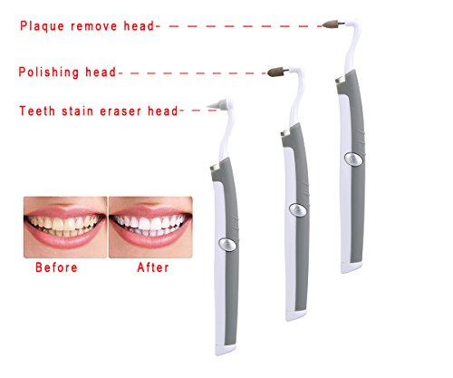 Flylinktech LED Dental Sonic Tool 3-in-1 Teeth Whitening Fleckentfernung Polieren Plaque-Kit mit 3 verschiedenen Köpfen + 2 Batterien - 2