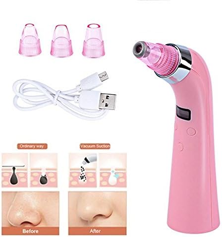 xincare Blackhead Remover for Women and Men,USB Rechargeable LCD Blackhead Vacuum Suction Removal Pore Cleaner Comedone Extractor,Electric Acne Comedo Microdermabrasion Exfoliating Machine with 4 Replaceable Suction Heads (Pink)