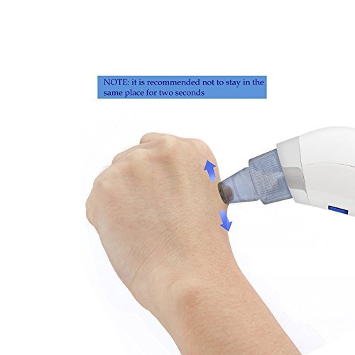 Beautystar poren sauger Elektro porenreiniger Schönheit Instrument an die Oberfläche der Haut reinigen Mitesser akne remover - 6