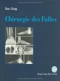 Image de Chirurgie des Fußes