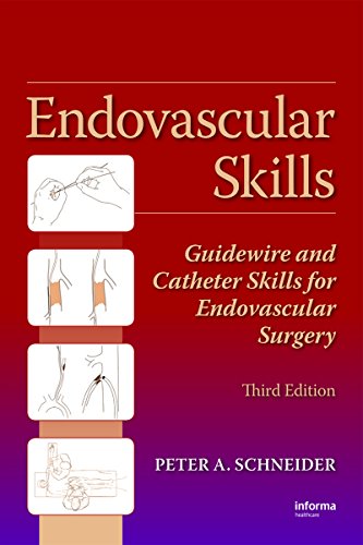 Endovascular Skills: Guidewire and Catheter Skills for Endovascular Surgery, Third Edition (English Edition) livre