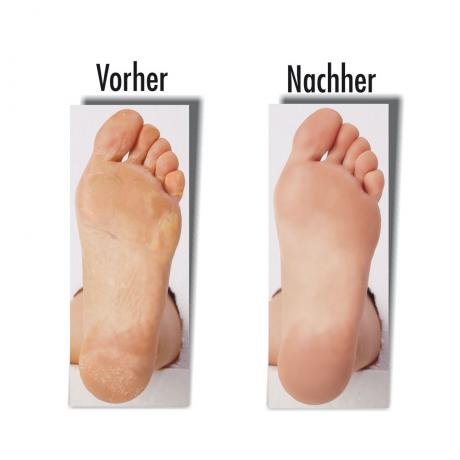 SamtFüssli – Hornhautsocke – Streichelzarte Füße mit nur einer Anwendung 5er – Set DAS ORIGINAL DES TV-LIEFERANTEN!!! - 3