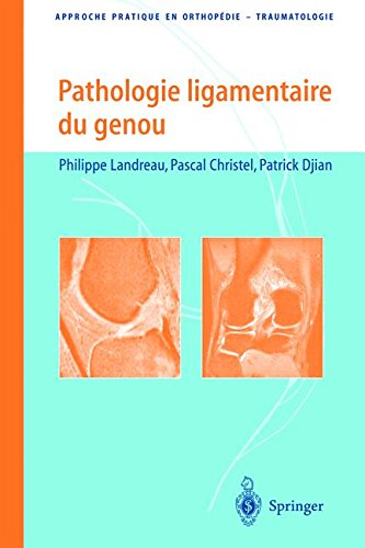 Download Pathologie Ligamentaire Du Genou Pdf Richardsuresh - 